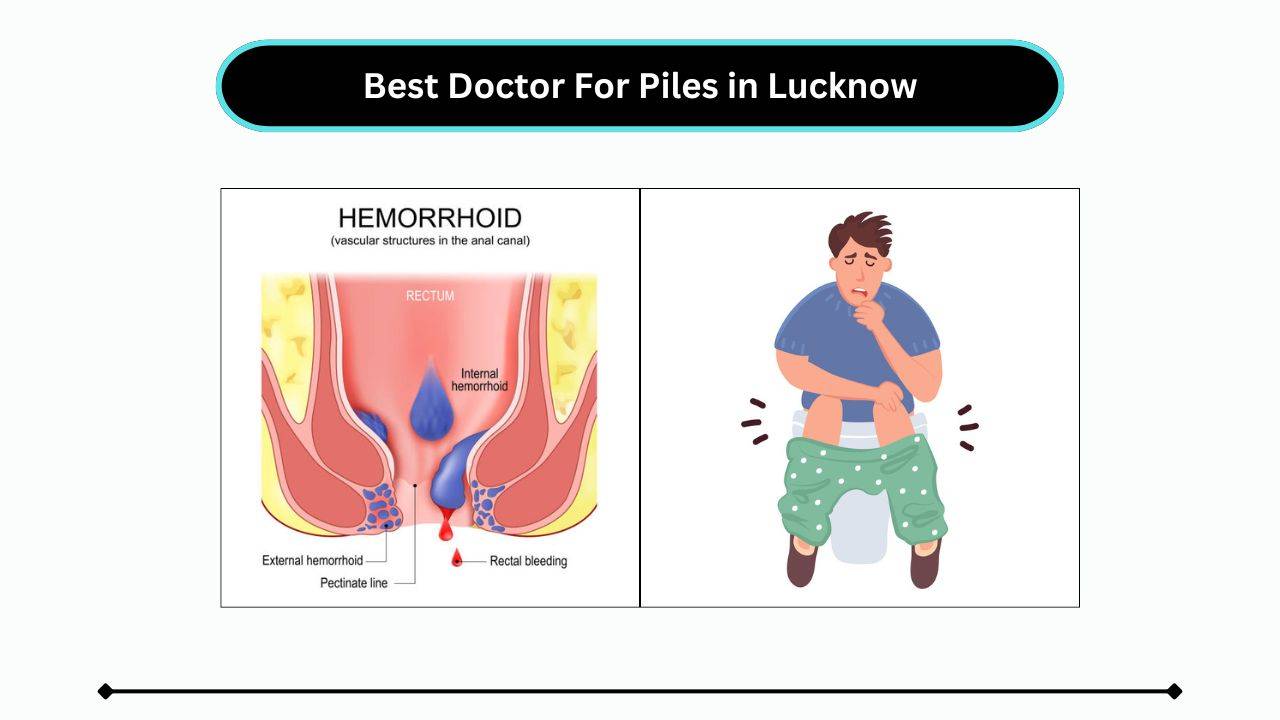 Best Doctor For Piles in Lucknow